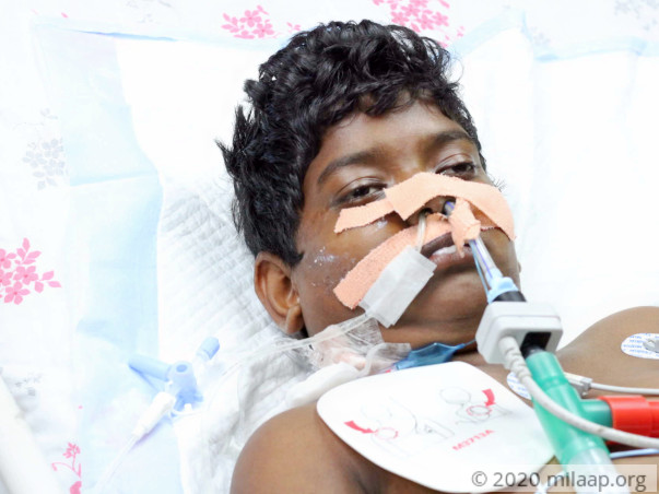 Young Boy Lost His Voice Due To Severe Infection, Needs Urgent Help