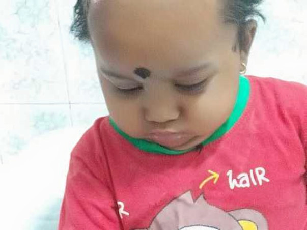 Please Help My 18 Month Old Child Fight Acute Lymphoblastic Leukemia