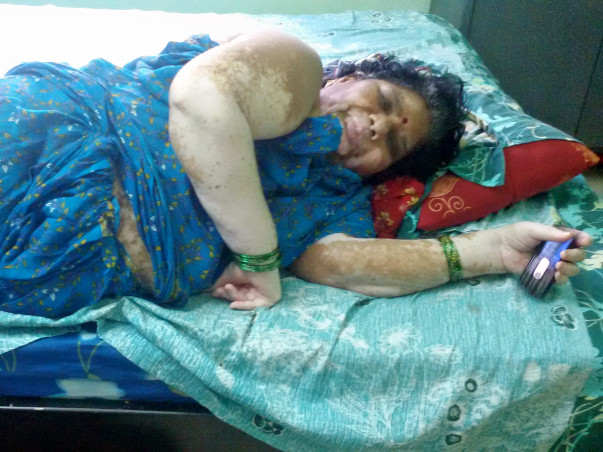 Bolster Syamala's health by backing her who suffering withLIVER CANCER