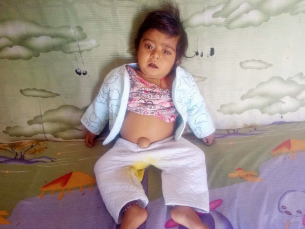 He Needs An Urgent Liver Transplant To Stay Alive For His 1st Birthday