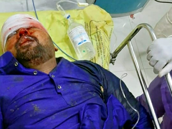30 Years Old Bhaskar Rao Needs Your Help Fight Accident