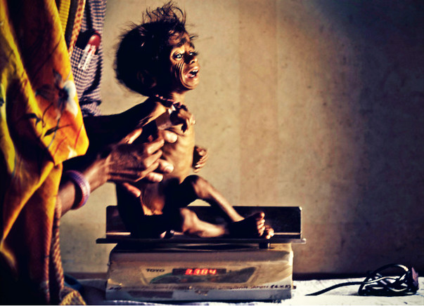 Save a Tribal Child from Hunger | June-July 2017
