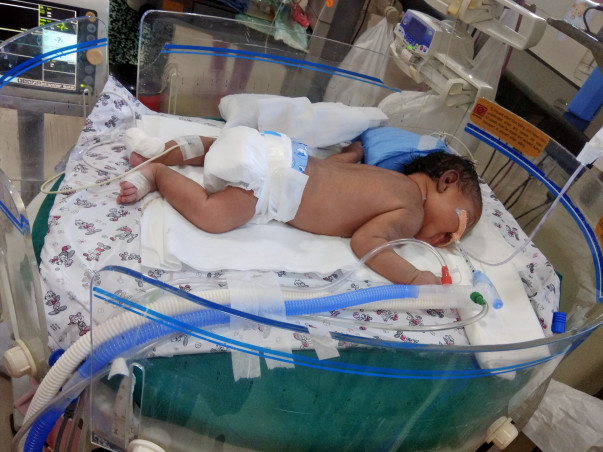Help Baby of Kiran Kumar