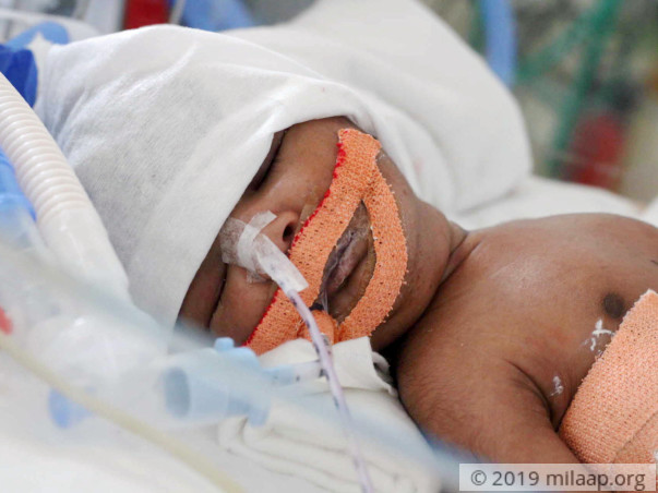 Help Baby of valli to fight disease