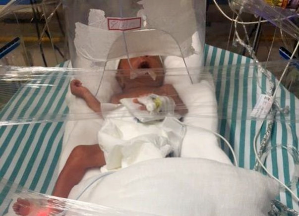 Help Baby Of Romana Parvin Get NICU Treatment