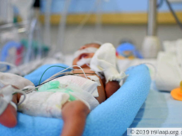 extremely underweight newborn baby needs your help to survive milaap newborn baby needs