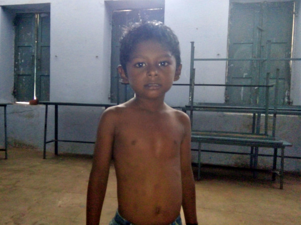 Help 5-year-old-Annamalai undergo heart surgery