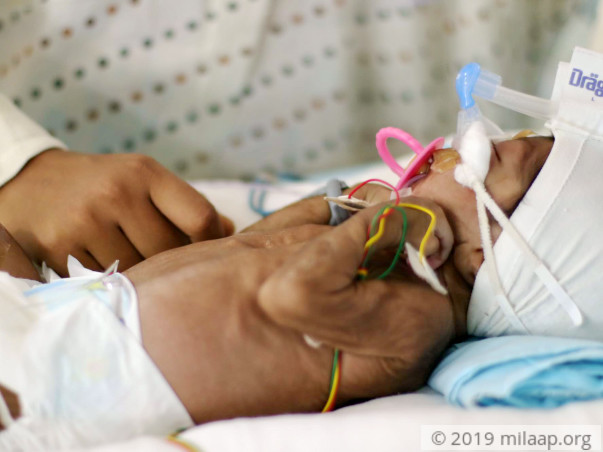 His Parents Will Soon Have No Choice But To Take Him Off Life-Support