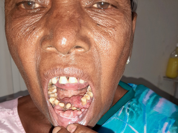 I am helpless, please help me to fight cancer
