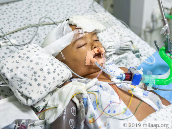Help Aradhya Undergo An Urgent Decompressive Craniotomy