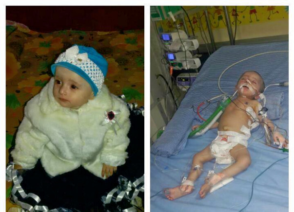 Help 1-Year-Old Inaya Naaz To Fight Pulmonology Edema