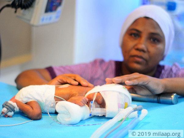 Despite Her Sickness, Mother Fights To Save Her Premature Baby's Life