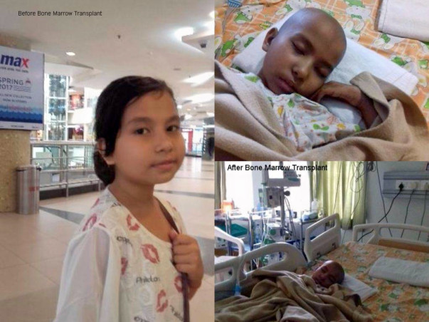 Help A Precious Daughter Pragya For Her Bone Marrow Treatment