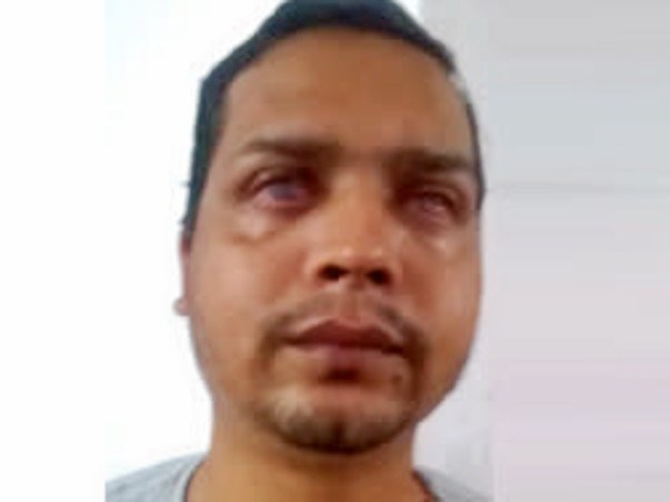 Help Premsingh Undergo An Eye Operation