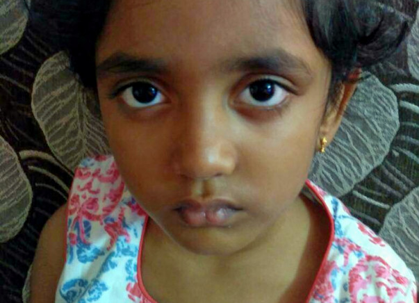 At 5, She Has No Idea What Cancer Is; But She Is Fighting It Bravely.
