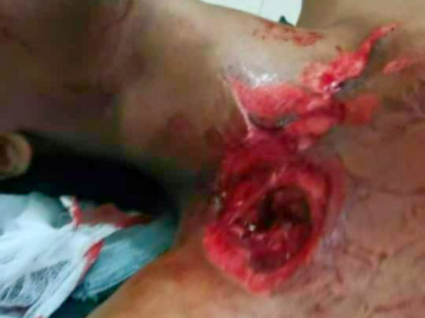 Help Me Recover From Accident