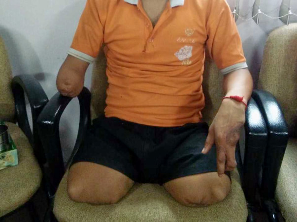 Help Suraj Walk Again