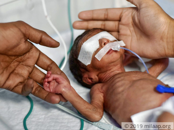 Help Twins of Pooja to survive
