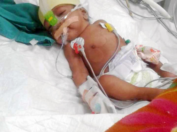 Support Baby Of Mamta recover From Severe Pneumonia