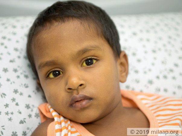 Weaver Begs Village To Save His 3-year-old Son From Liver Failure