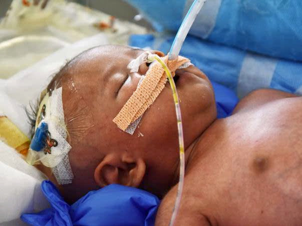Help Ambika save her premature baby