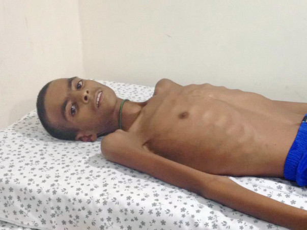 Help 16-year-old Shabaz recover from severe malnutrition