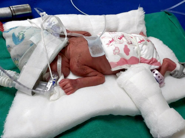 HELP FOR SAVE MY BABY GIRL