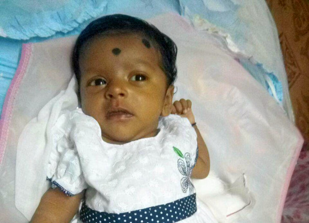 Help our 10-month-old baby girl undergo liver transplant
