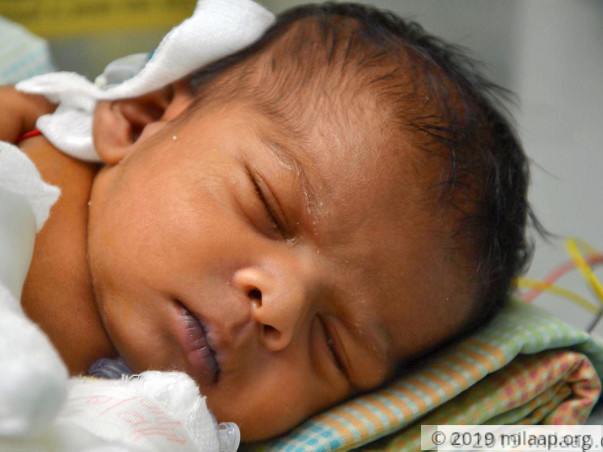 Baby of vijalakshmi needs your help to survive