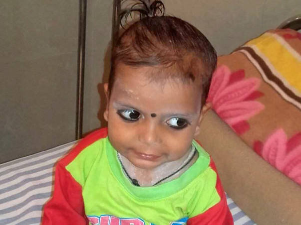 Help 2-Year-Old Viraj Fight Against Blood Cancer