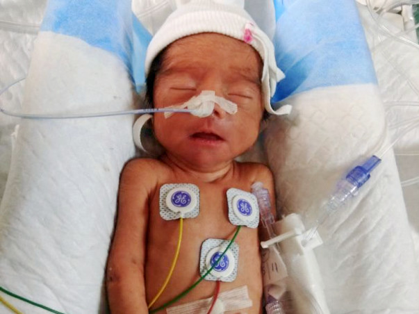 Help Baby Of Priya, Who was Born Premature And Is InNICU.