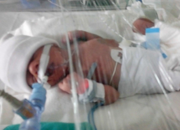 Help 5 days old boy fighting with Respiratory distress