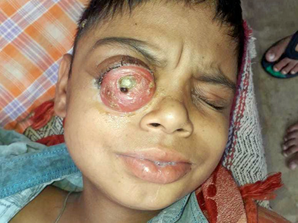 Help My 12 Years Old Son Vansh Fight Cancer.