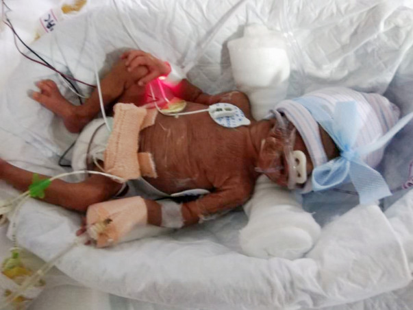 Help PrematureTwins who are now in the ICU fighting for their lives