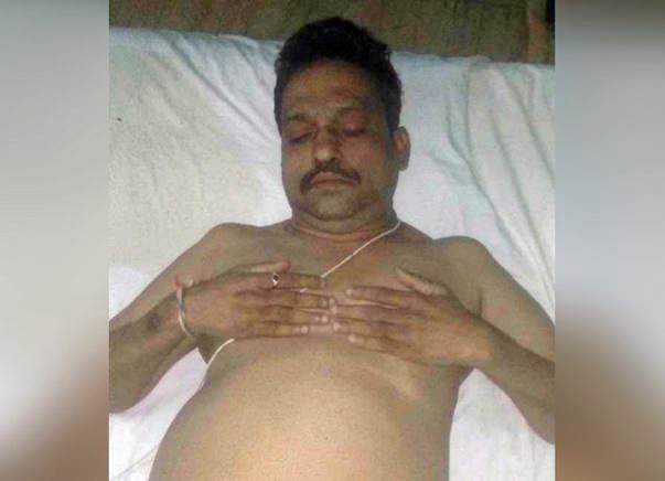 Please Help Me Raise Funds For My Father's Liver Transplantation