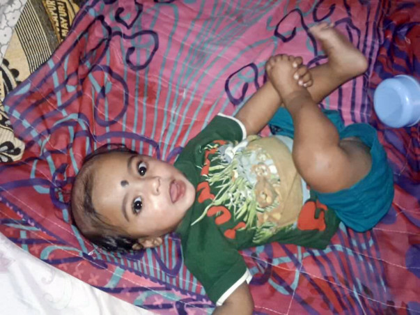 8-Month-Old Thanvik May Die Of Infections Without Your Help