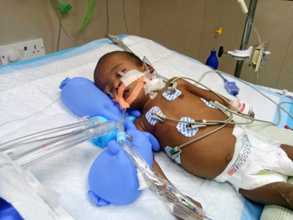 My 6-month-old Baby Has Been Fighting To Live Every Day