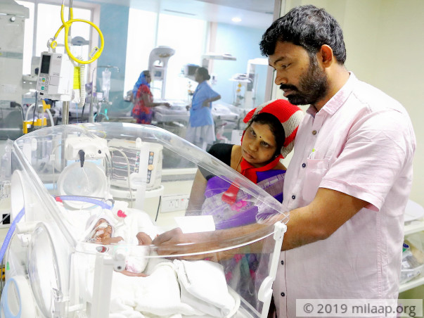 Palm-Sized Twin Babies Weighing Just A Few Grams, Need Urgent Help