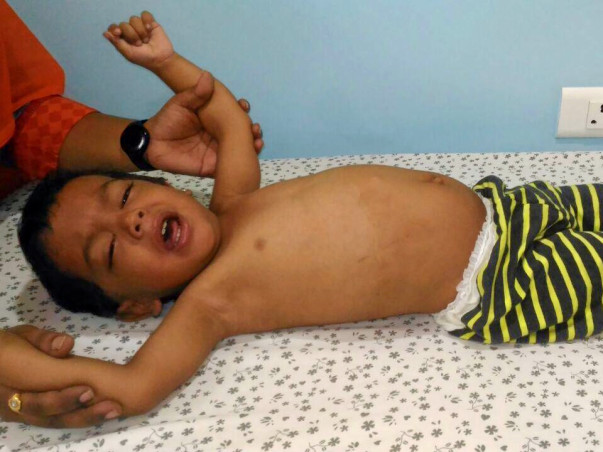Help 2-year-old Baby Boy Riyansh fight a severe liver disease