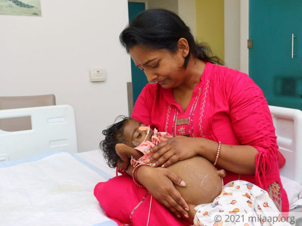 Sanvi Needs Urgent Liver Transplant To Live