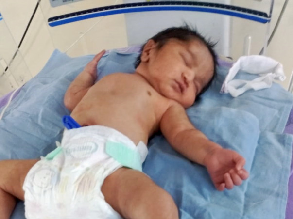 Help 2-Month-Baby Suffering From Bronchomalacia