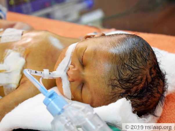 12-Day-Old Baby Girl Who Struggles For Every Breath Needs Urgent Help