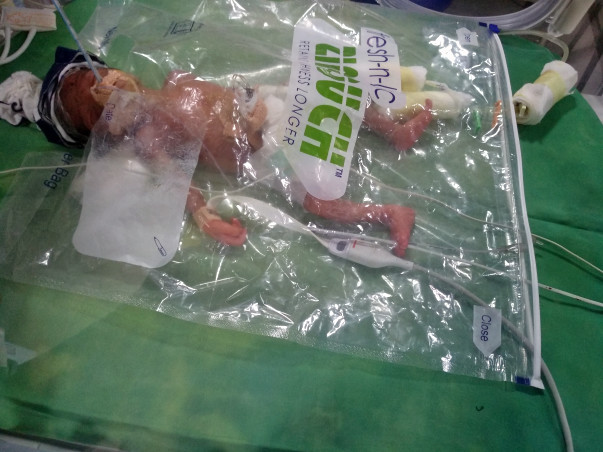 Help Prabhakar's son to come out of NICU