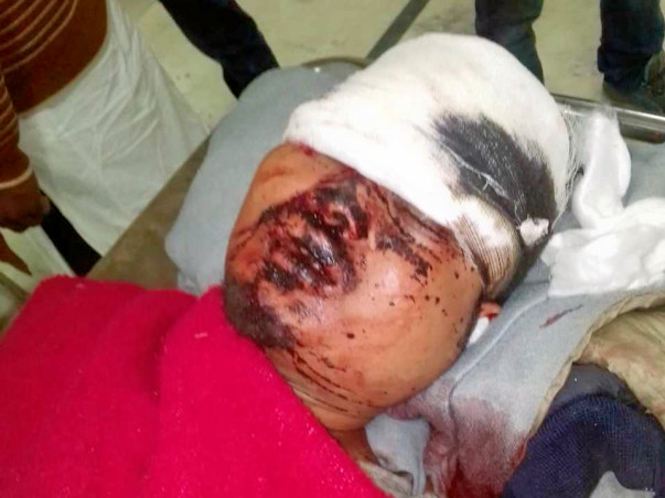 Help Mehboob Hussain Recover