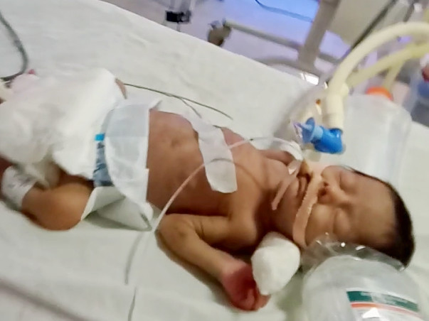 Help Baby Shafiuddin Fight Premature Birth Complications