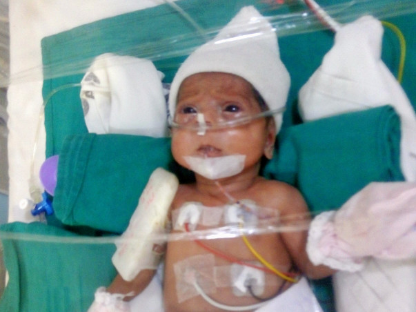 Help Preterm Twins Of Pallavi Suffering From Chronic Lung Disease