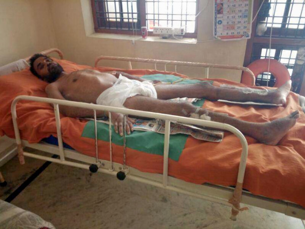Help Bhanu fight full paralysis(neck-down) due to Spinal Cord fusion