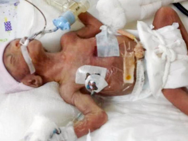 Help The Parents Save Their Young Lakshmi