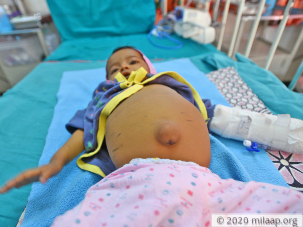 Prisha Malvadkar needs your help to undergo Liver transplant