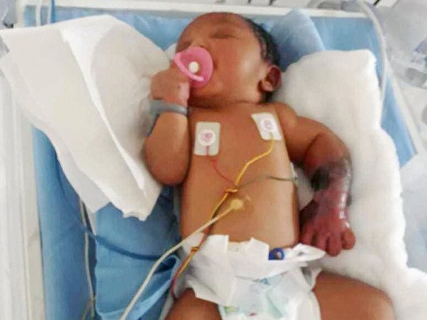Help This New Born Whose Left Limb Is Infected By Gangrene Since Birth